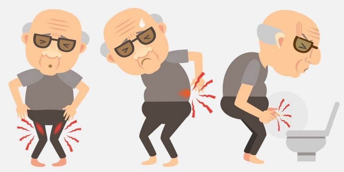 príznaky prostatitídy